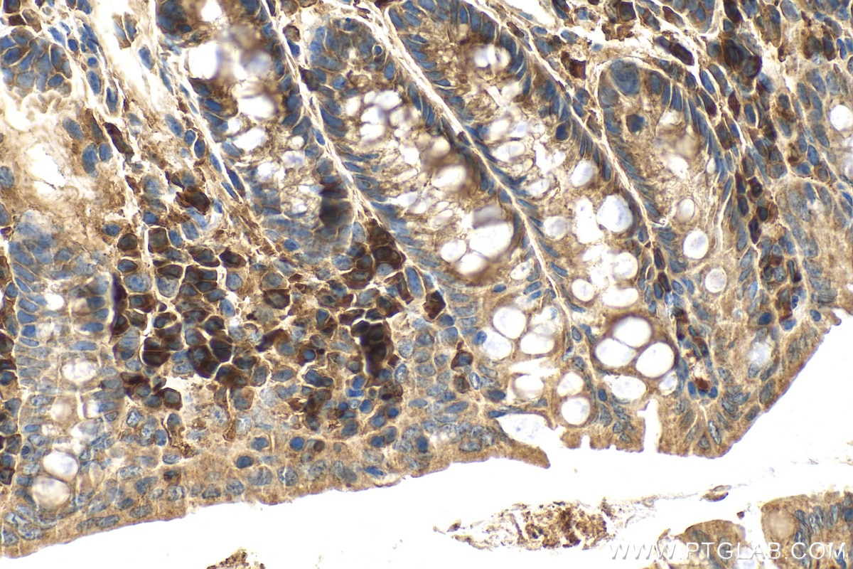 Immunohistochemistry (IHC) staining of mouse colon tissue using METTL2 Polyclonal antibody (16983-1-AP)