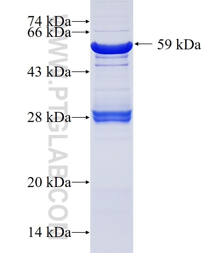 METTL2B fusion protein Ag10410 SDS-PAGE