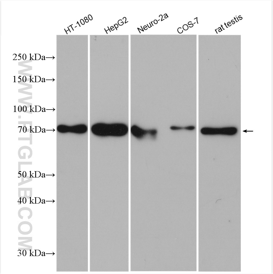 Western Blot (WB) analysis of various lysates using METTL3 Polyclonal antibody (15073-1-AP)