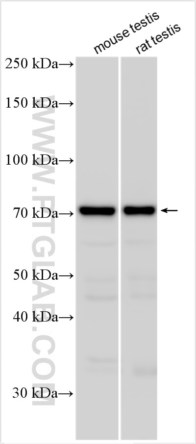 Western Blot (WB) analysis of various lysates using METTL3 Polyclonal antibody (15073-1-AP)