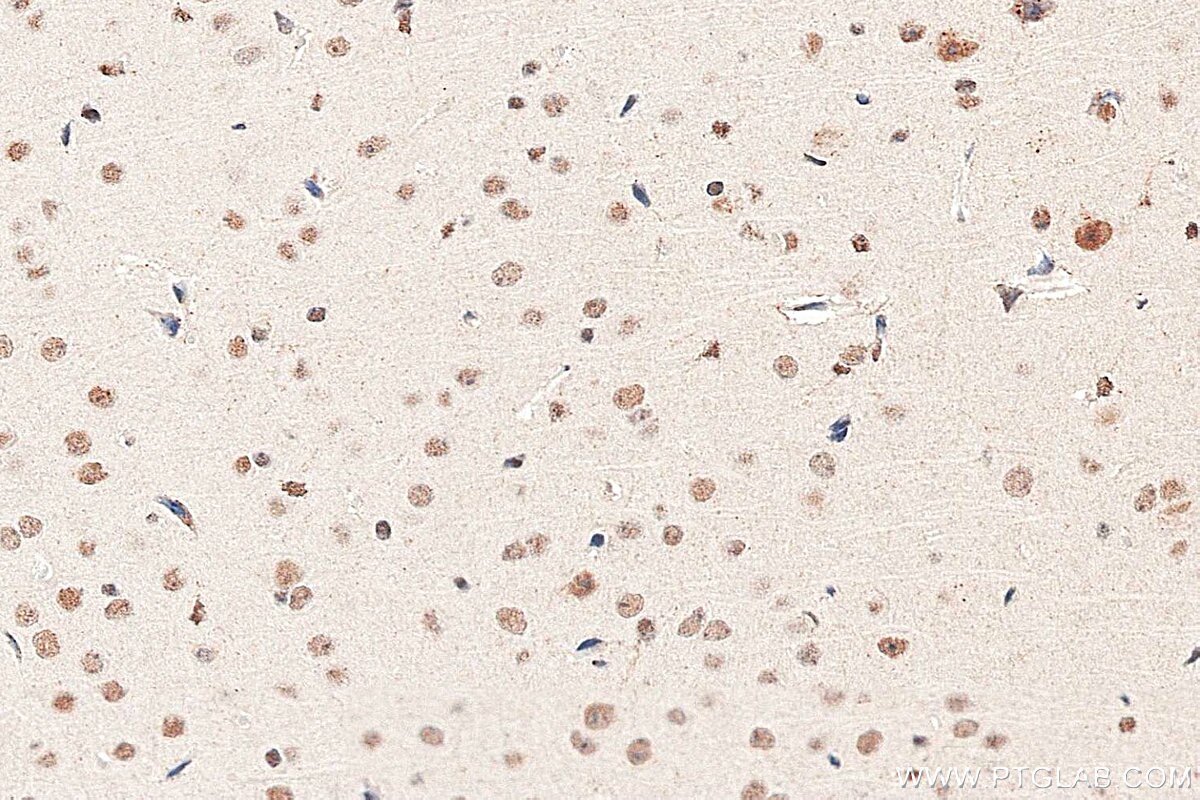 Immunohistochemistry (IHC) staining of mouse brain tissue using METTL3 Polyclonal antibody (29314-1-AP)