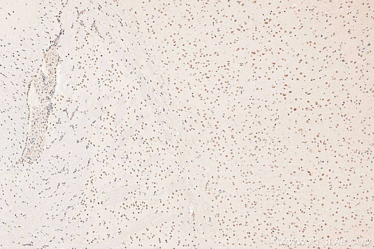 Immunohistochemistry (IHC) staining of mouse brain tissue using METTL3 Polyclonal antibody (29314-1-AP)