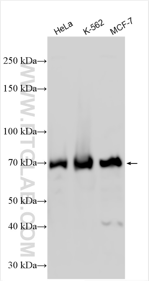 Western Blot (WB) analysis of various lysates using METTL3 Polyclonal antibody (29314-1-AP)