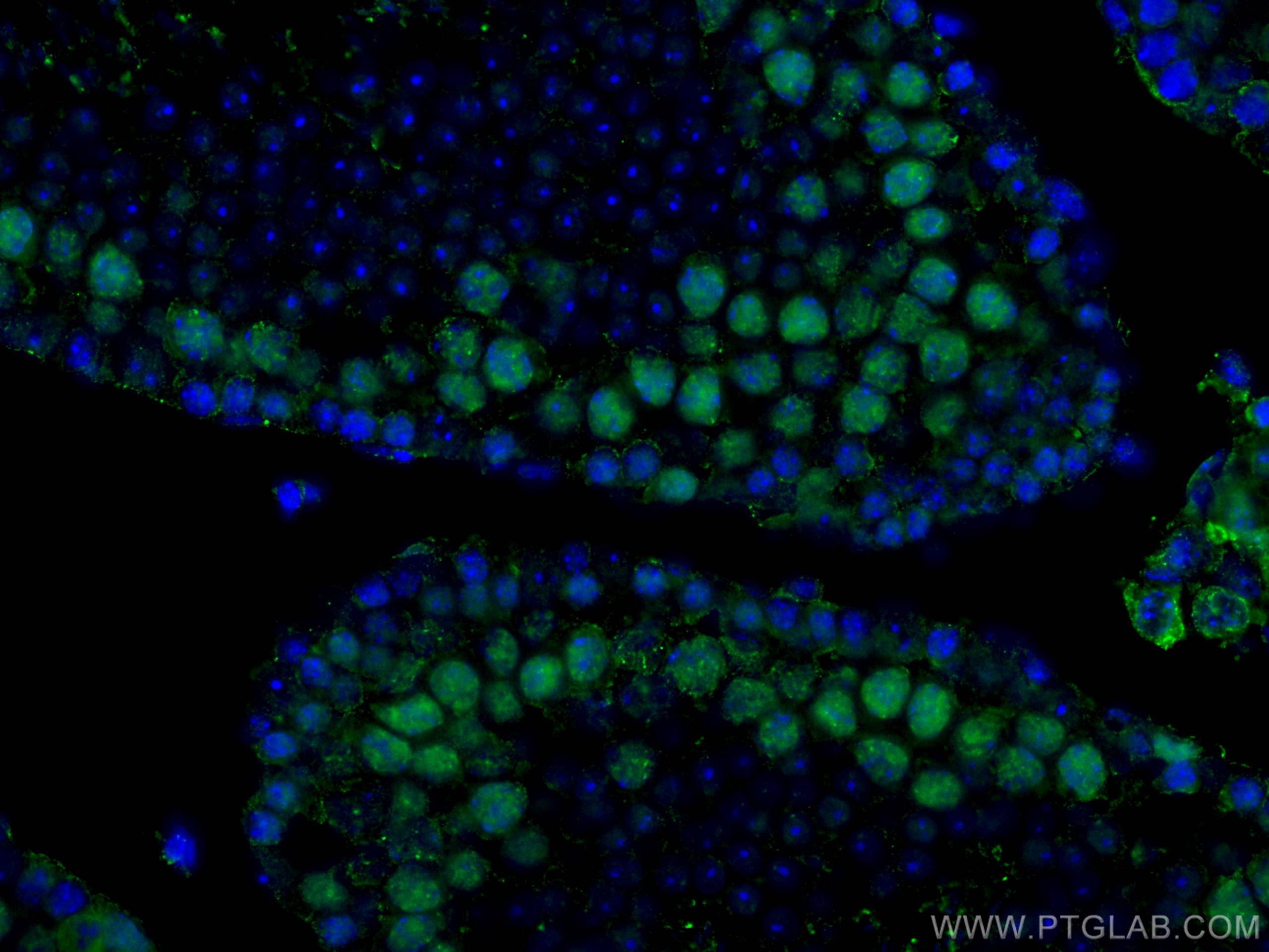IF Staining of mouse testis using 67733-1-Ig
