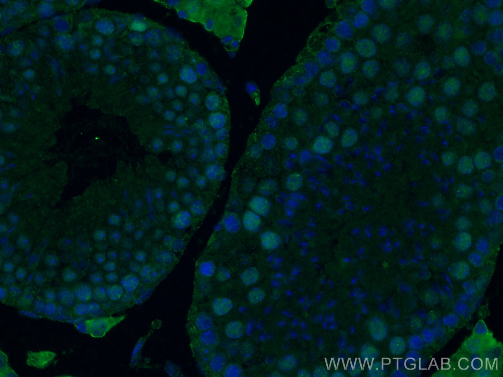 Immunofluorescence (IF) / fluorescent staining of mouse testis tissue using METTL3 Monoclonal antibody (67733-1-Ig)