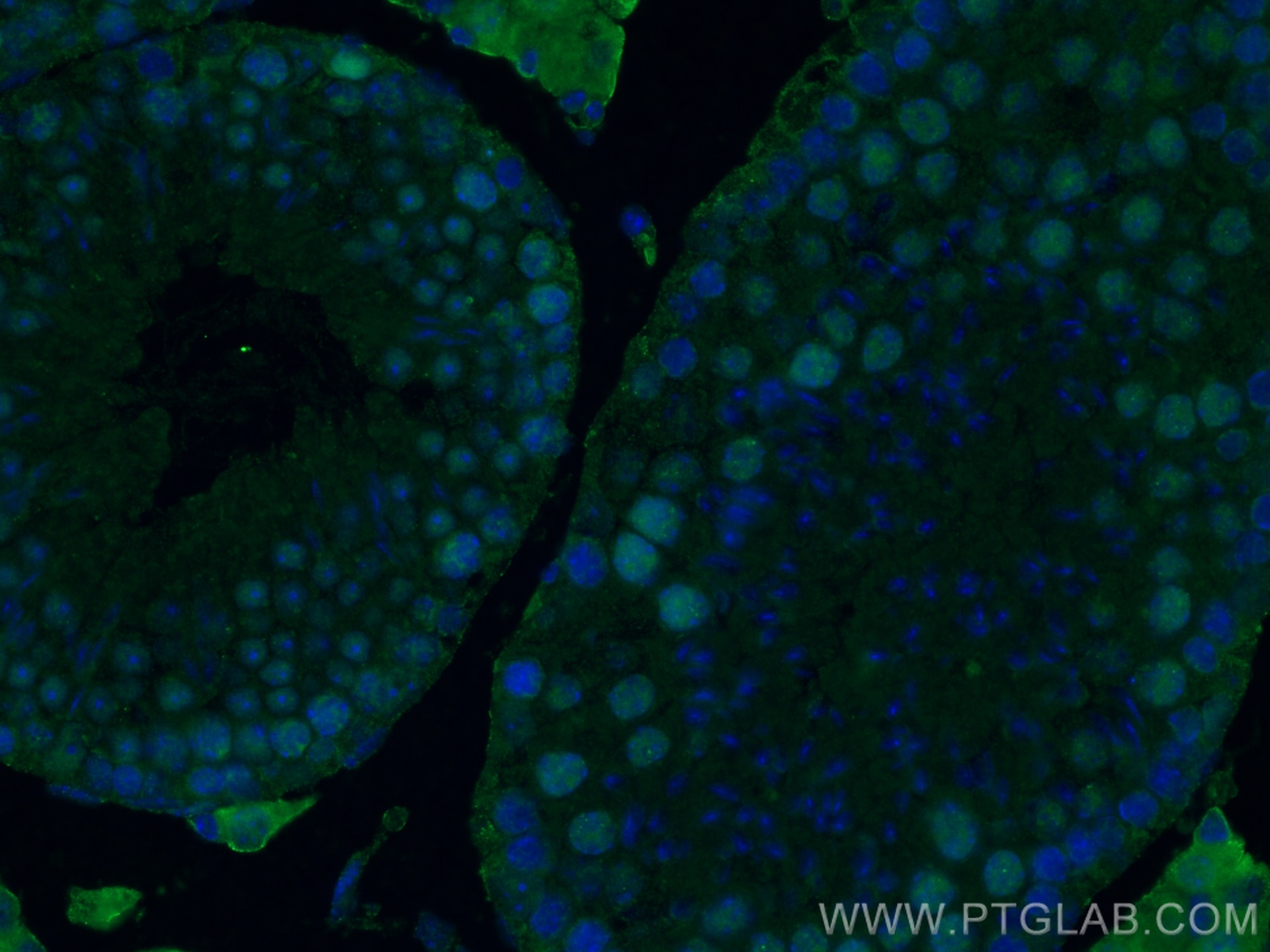 IF Staining of mouse testis using 67733-1-Ig