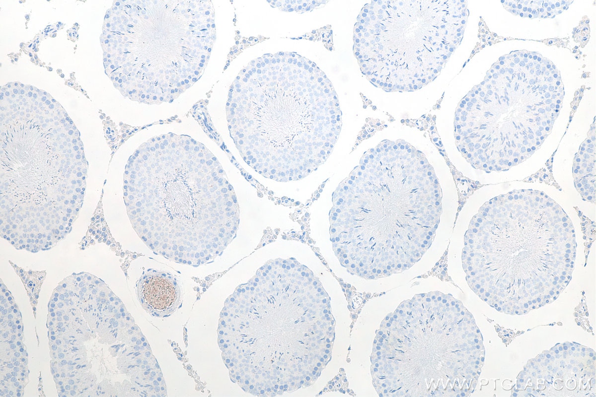 Immunohistochemistry (IHC) staining of rat testis tissue using METTL3 Monoclonal antibody (67733-1-Ig)