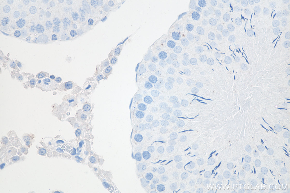 Immunohistochemistry (IHC) staining of rat testis tissue using METTL3 Monoclonal antibody (67733-1-Ig)