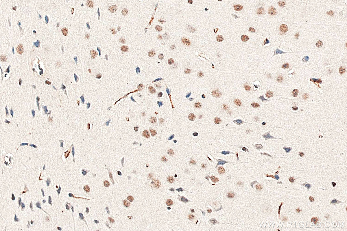 Immunohistochemistry (IHC) staining of mouse brain tissue using METTL3 Monoclonal antibody (67733-1-Ig)