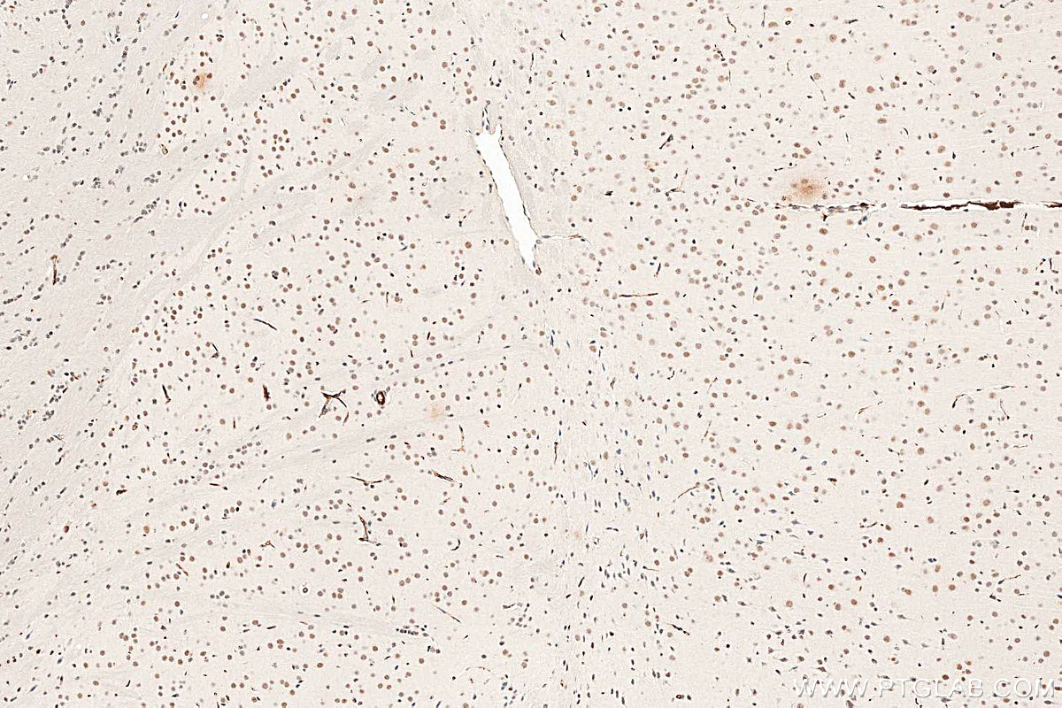 Immunohistochemistry (IHC) staining of mouse brain tissue using METTL3 Monoclonal antibody (67733-1-Ig)