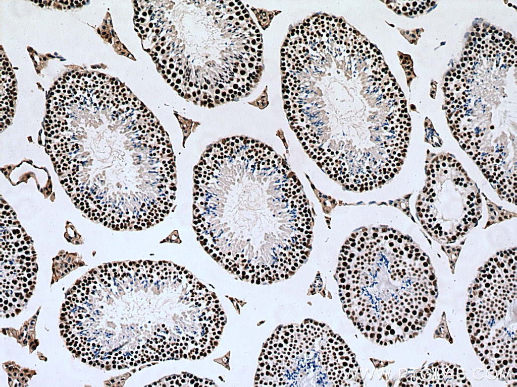 IHC staining of mouse testis using 67733-2-Ig