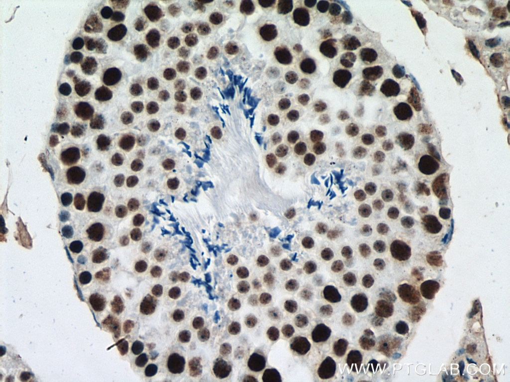 Immunohistochemistry (IHC) staining of mouse testis tissue using METTL3 Monoclonal antibody (67733-2-Ig)