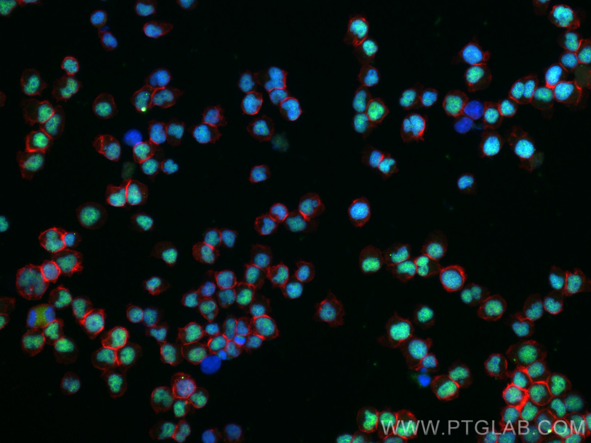 Immunofluorescence (IF) / fluorescent staining of Jurkat cells using METTL3 Recombinant antibody (80323-1-RR)