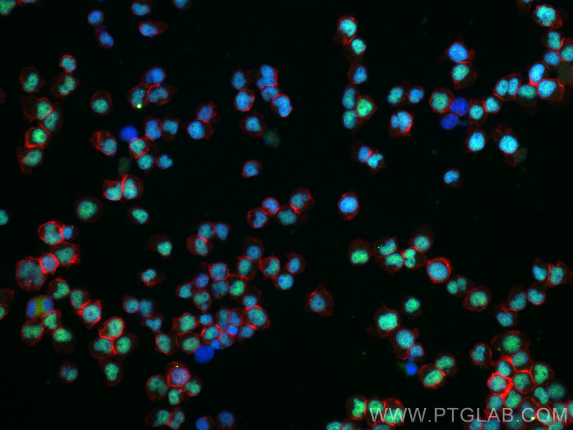 IF Staining of Jurkat using 80323-1-RR