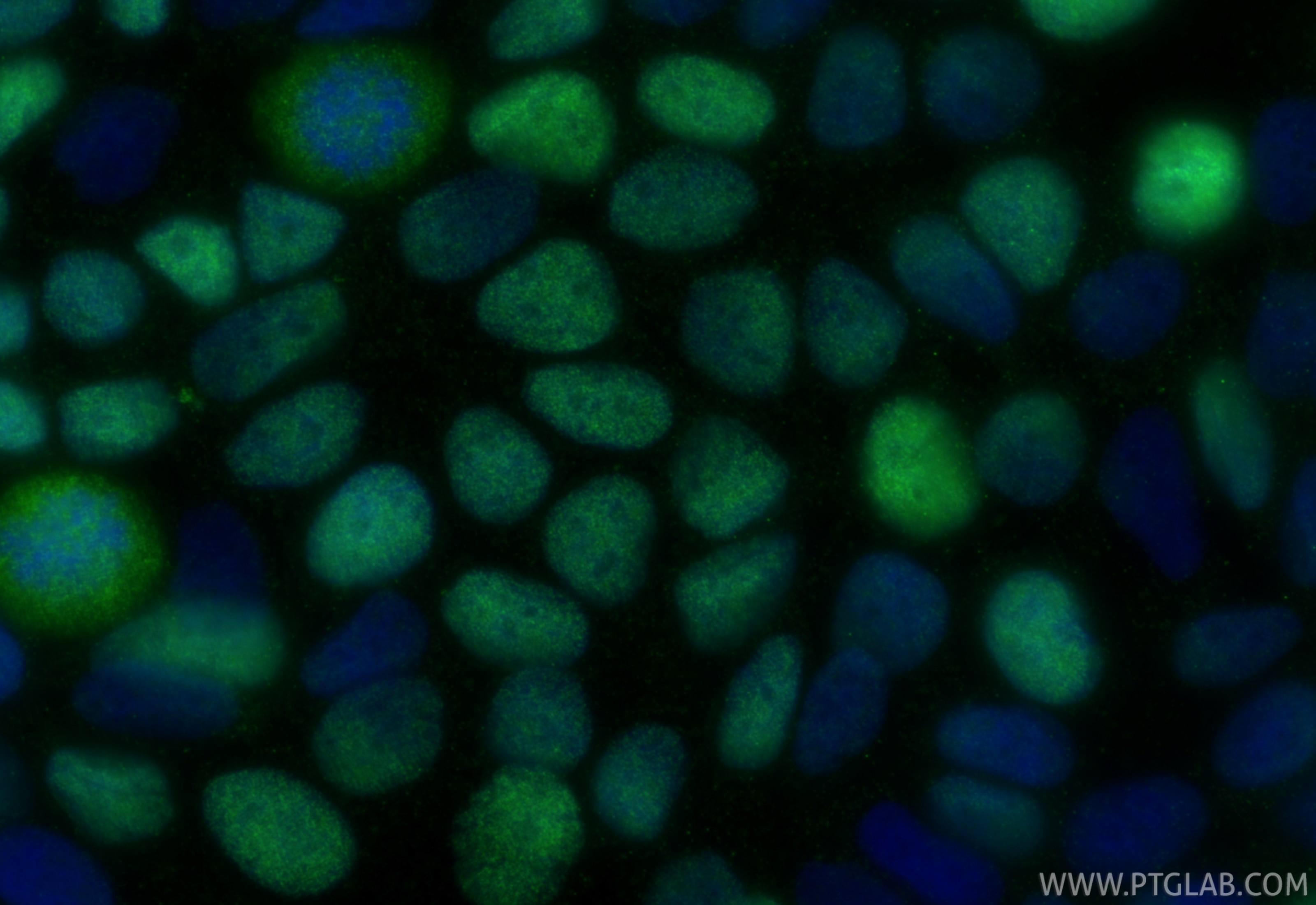Immunofluorescence (IF) / fluorescent staining of MCF-7 cells using METTL3 Recombinant monoclonal antibody (80323-1-RR)