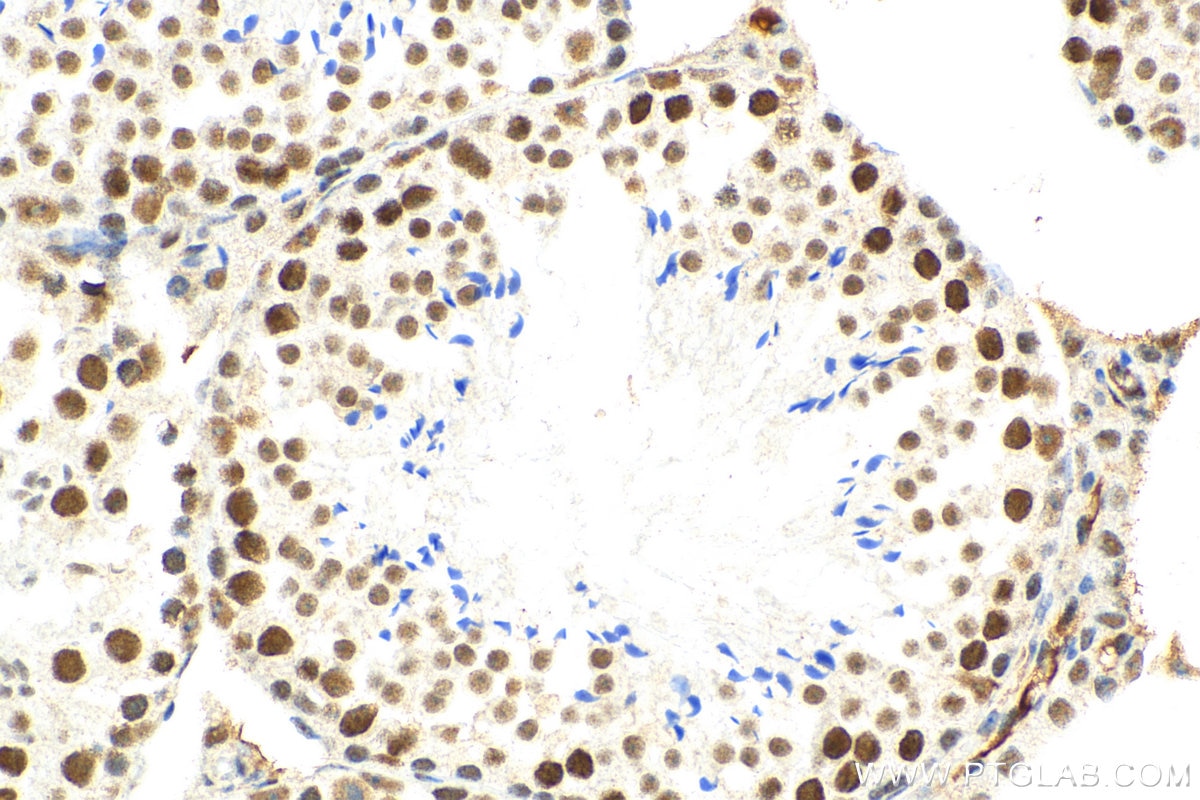 Immunohistochemistry (IHC) staining of mouse testis tissue using METTL3 Recombinant antibody (80323-1-RR)