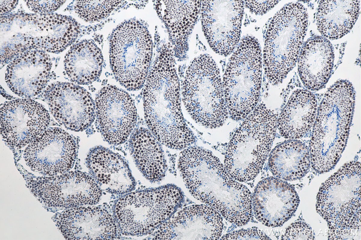 Immunohistochemistry (IHC) staining of mouse testis tissue using METTL3 Recombinant antibody (80323-1-RR)