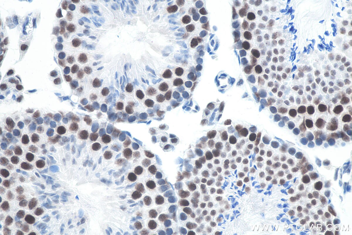 Immunohistochemistry (IHC) staining of mouse testis tissue using METTL3 Recombinant antibody (80323-1-RR)