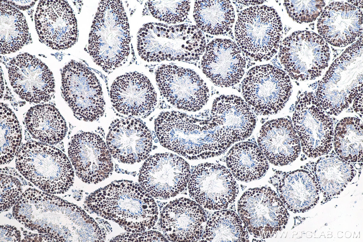 Immunohistochemistry (IHC) staining of mouse testis tissue using METTL3 Recombinant antibody (80323-1-RR)