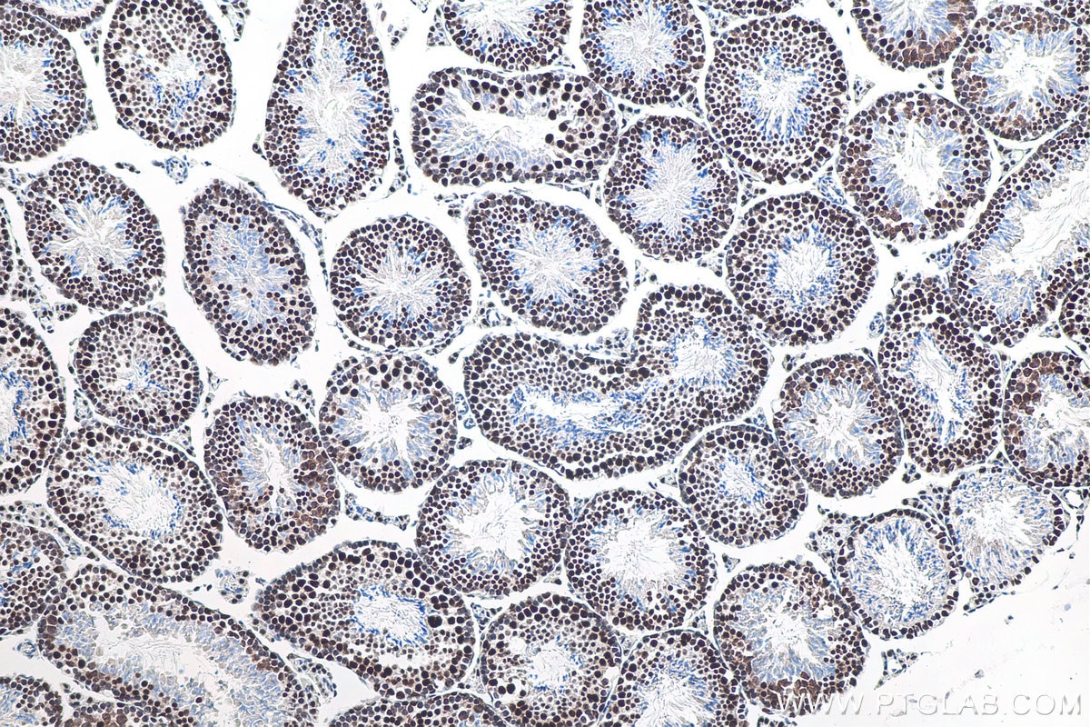 IHC staining of mouse testis using 80323-1-RR