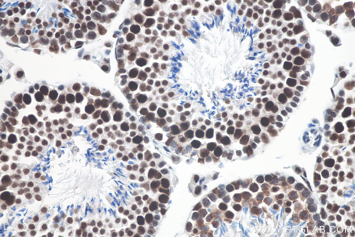 Immunohistochemistry (IHC) staining of mouse testis tissue using METTL3 Recombinant antibody (80323-1-RR)