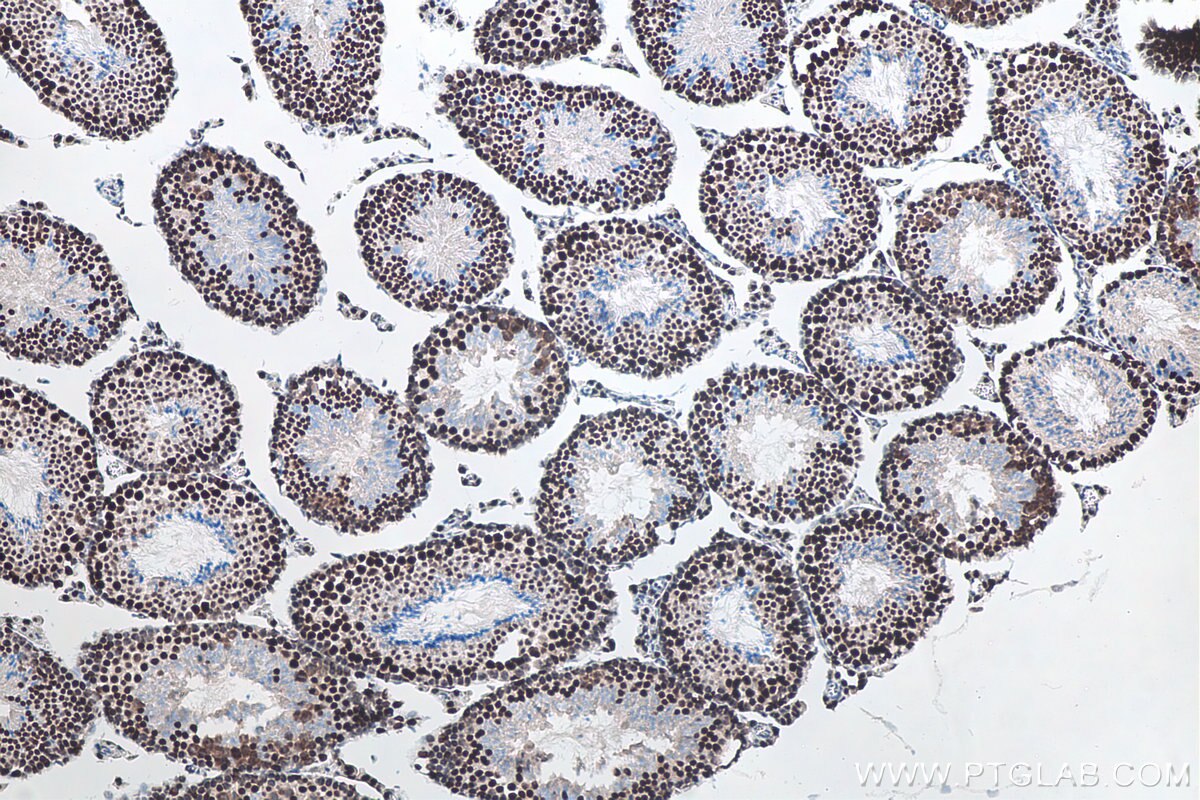 Immunohistochemistry (IHC) staining of mouse testis tissue using METTL3 Recombinant antibody (80323-1-RR)