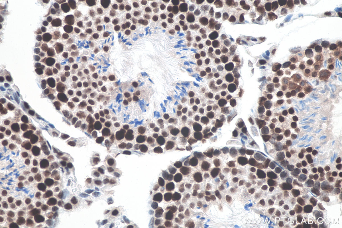 Immunohistochemistry (IHC) staining of mouse testis tissue using METTL3 Recombinant antibody (80323-1-RR)