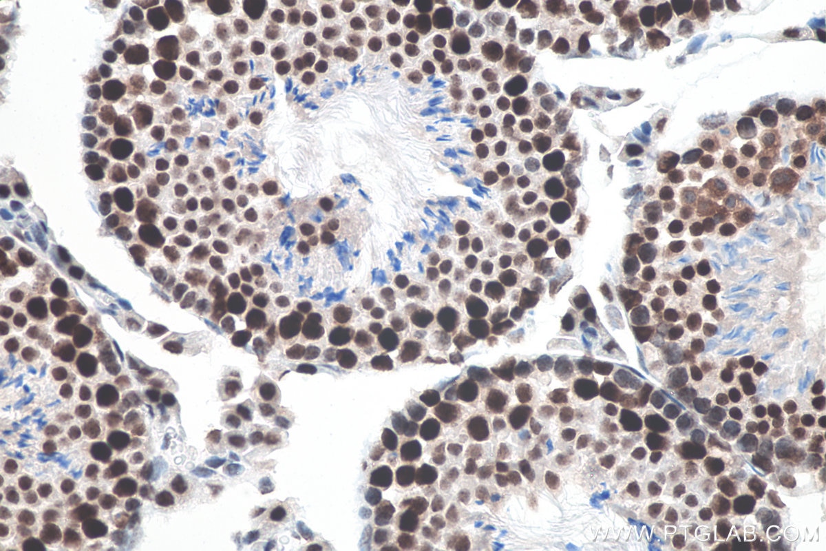 IHC staining of mouse testis using 80323-1-RR