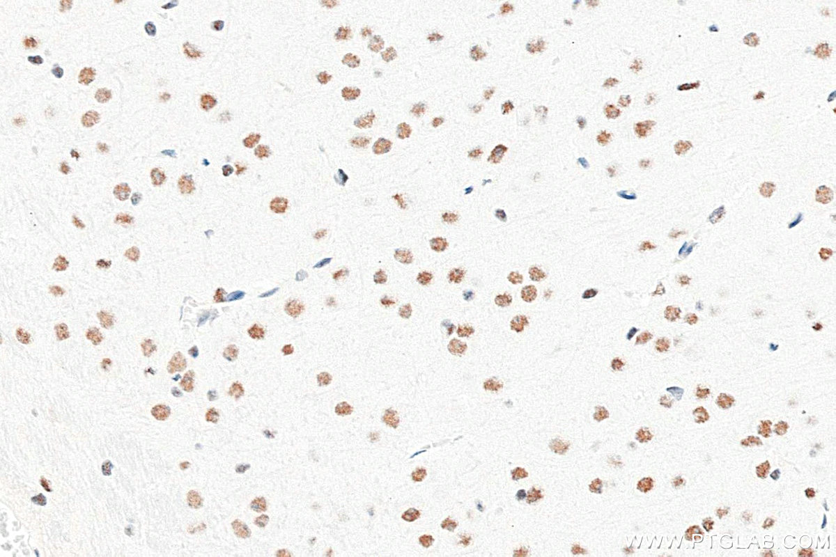 Immunohistochemistry (IHC) staining of mouse brain tissue using METTL3 Recombinant monoclonal antibody (80323-1-RR)