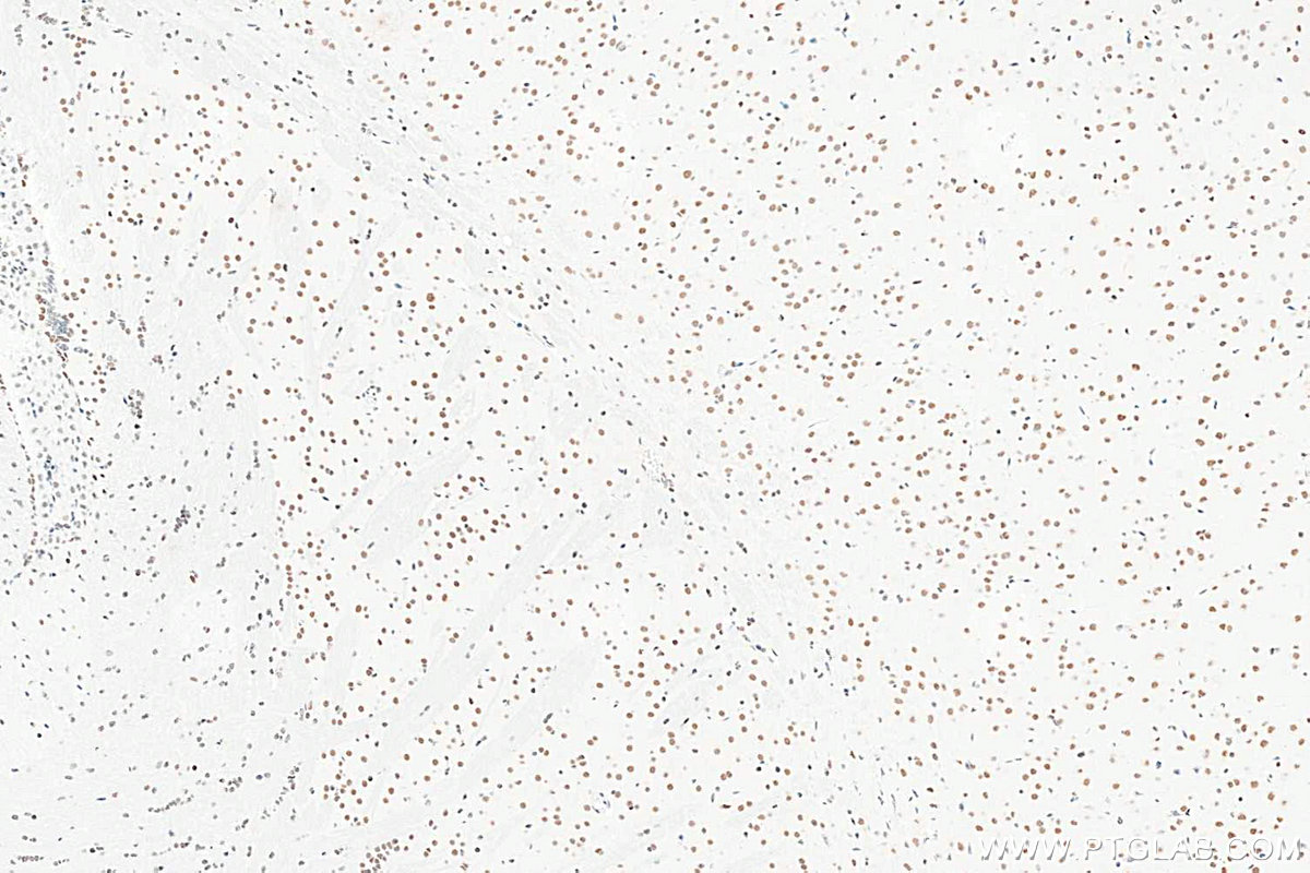 Immunohistochemistry (IHC) staining of mouse brain tissue using METTL3 Recombinant monoclonal antibody (80323-1-RR)