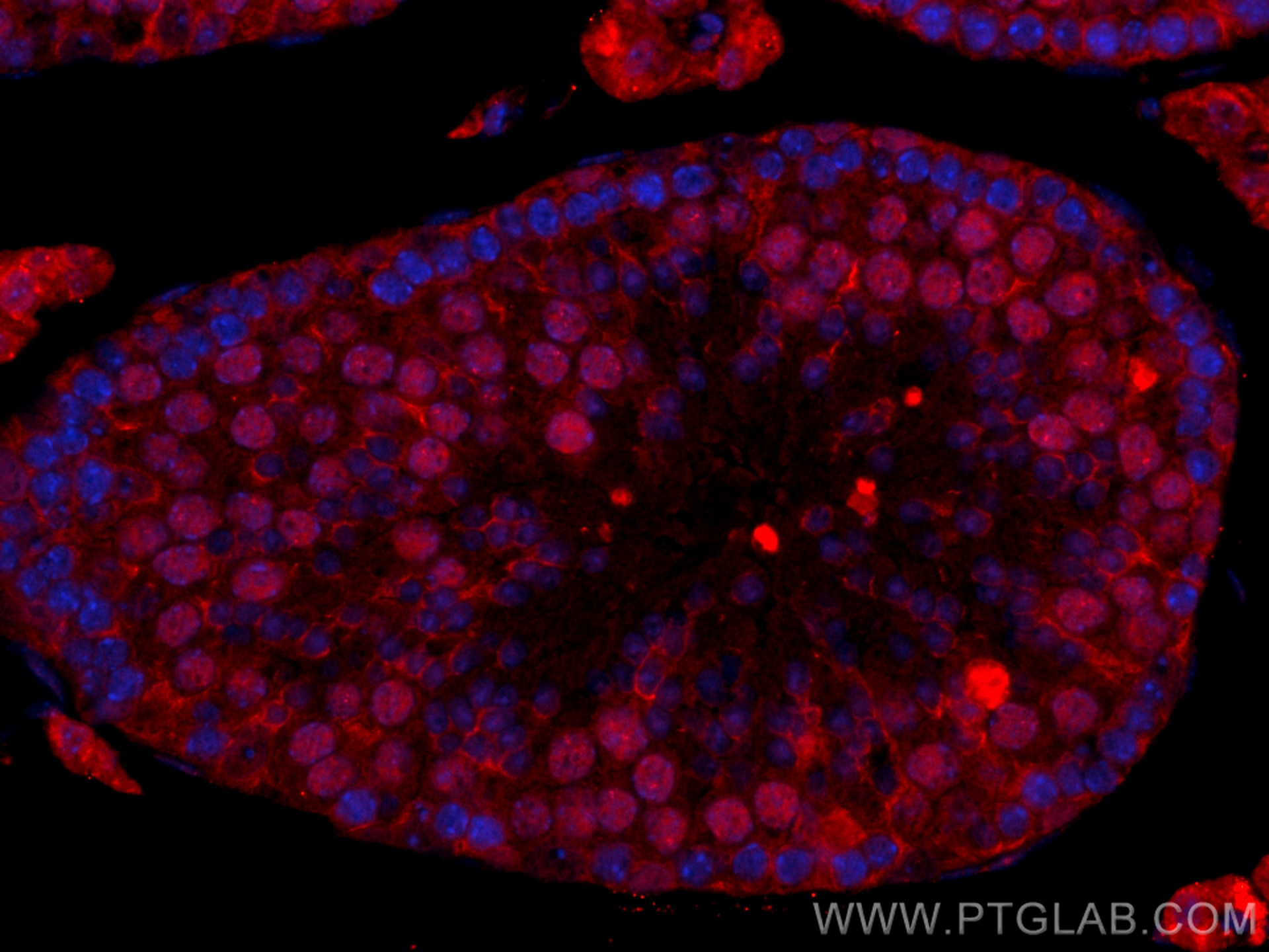 Immunofluorescence (IF) / fluorescent staining of mouse testis tissue using CoraLite®594-conjugated METTL3 Polyclonal antibody (CL594-15073)