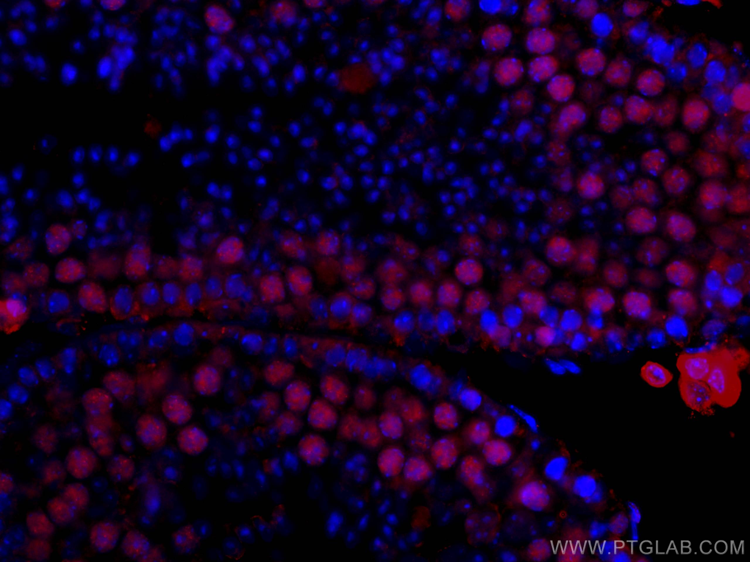 Immunofluorescence (IF) / fluorescent staining of mouse testis tissue using CoraLite®594-conjugated METTL3 Monoclonal antibody (CL594-67733)