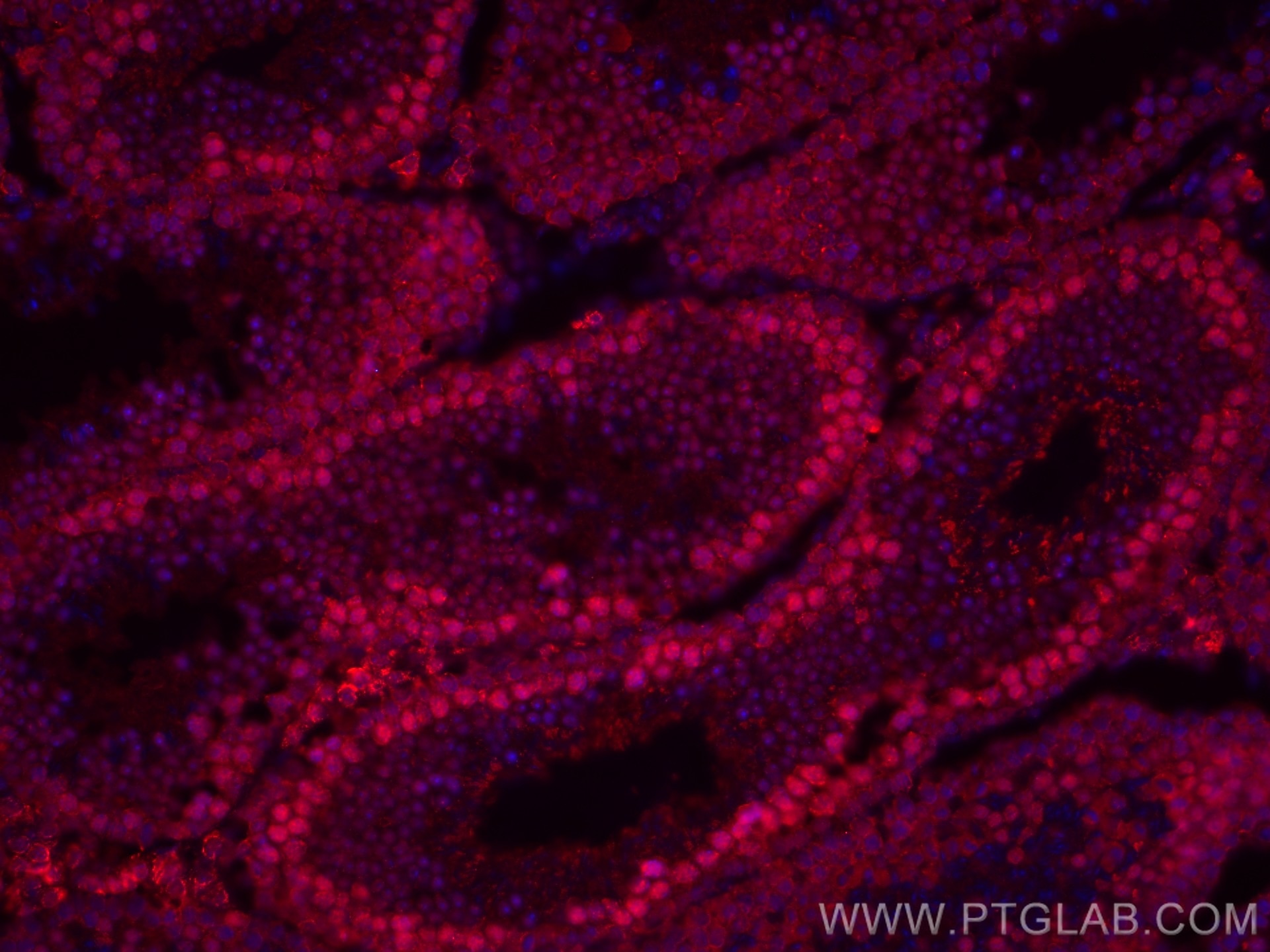 Immunofluorescence (IF) / fluorescent staining of mouse testis tissue using CoraLite®594-conjugated METTL3 Monoclonal antibody (CL594-67733)