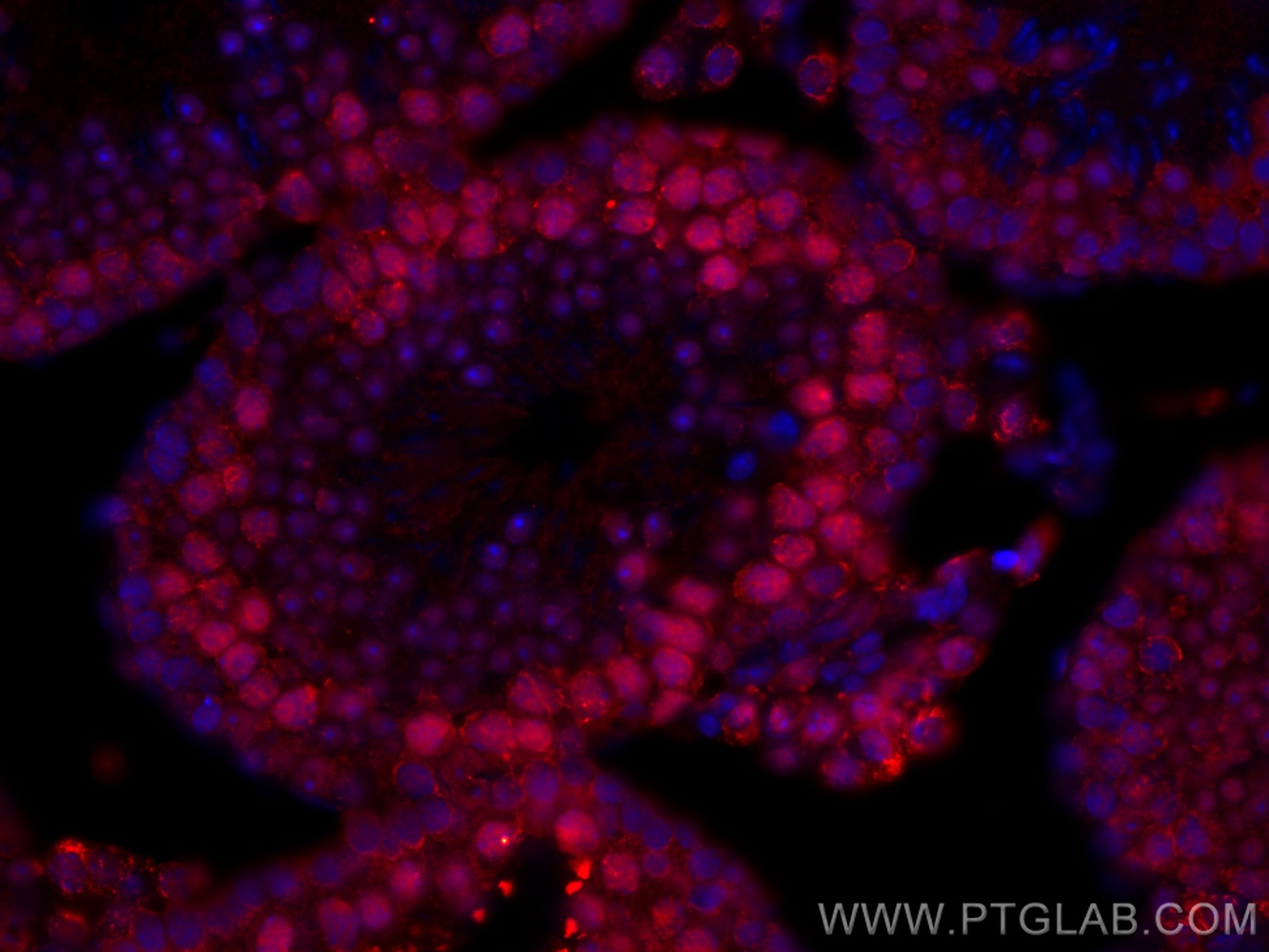 Immunofluorescence (IF) / fluorescent staining of mouse testis tissue using CoraLite®594-conjugated METTL3 Monoclonal antibody (CL594-67733)