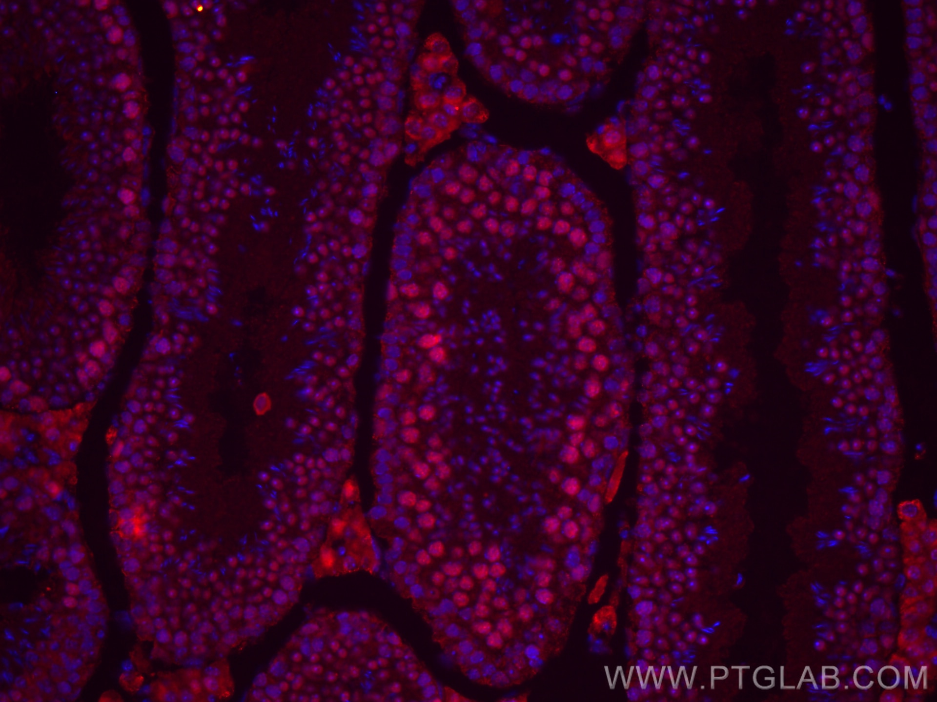 Immunofluorescence (IF) / fluorescent staining of mouse testis tissue using CoraLite®594-conjugated METTL3 Monoclonal antibody (CL594-67733)