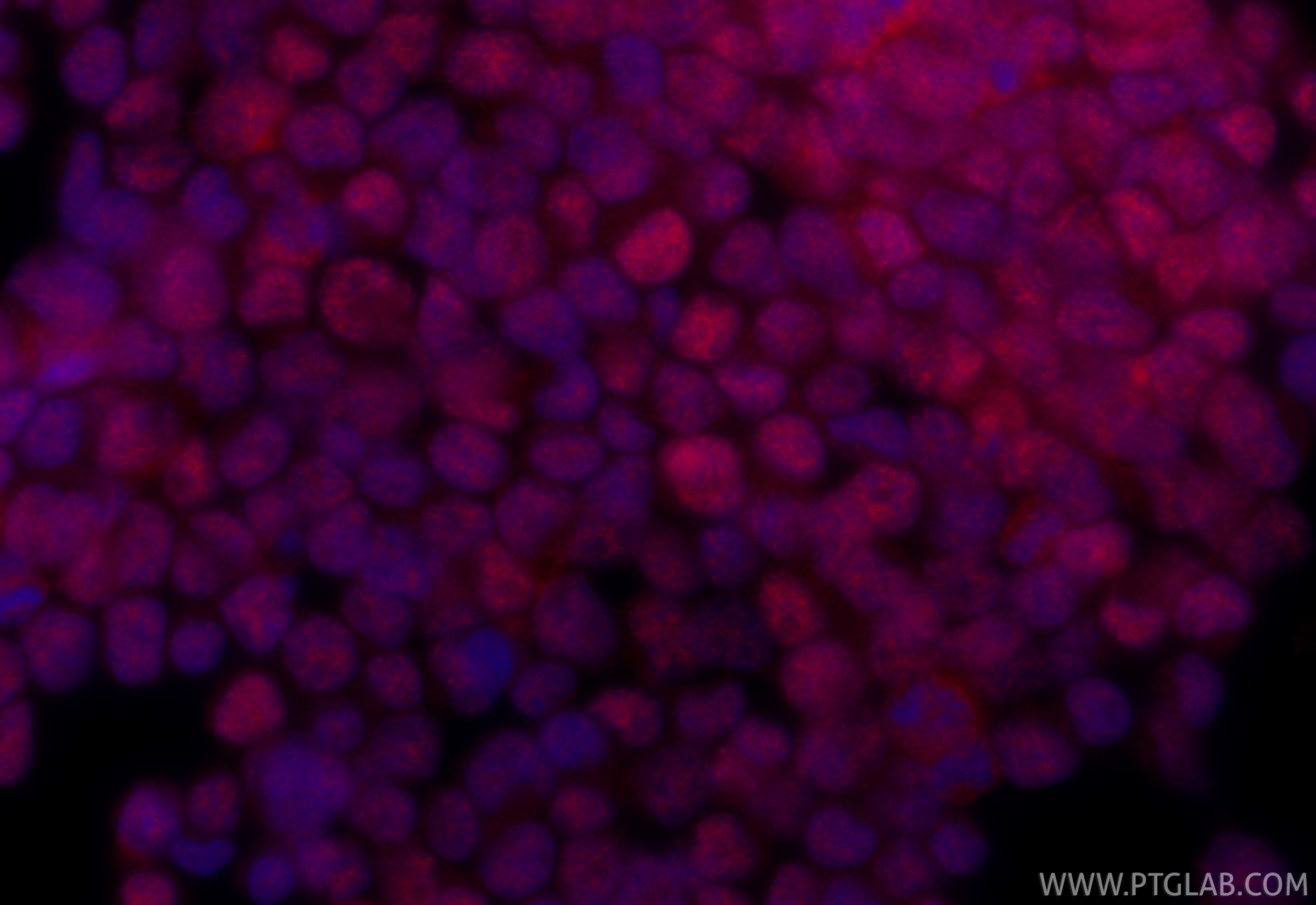 Immunofluorescence (IF) / fluorescent staining of Jurkat cells using CoraLite®594-conjugated METTL3 Recombinant monoclo (CL594-80323)