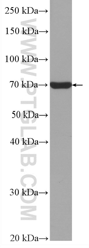 WB analysis of HeLa using HRP-67733