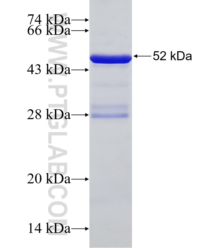 METTL3 fusion protein Ag30638 SDS-PAGE