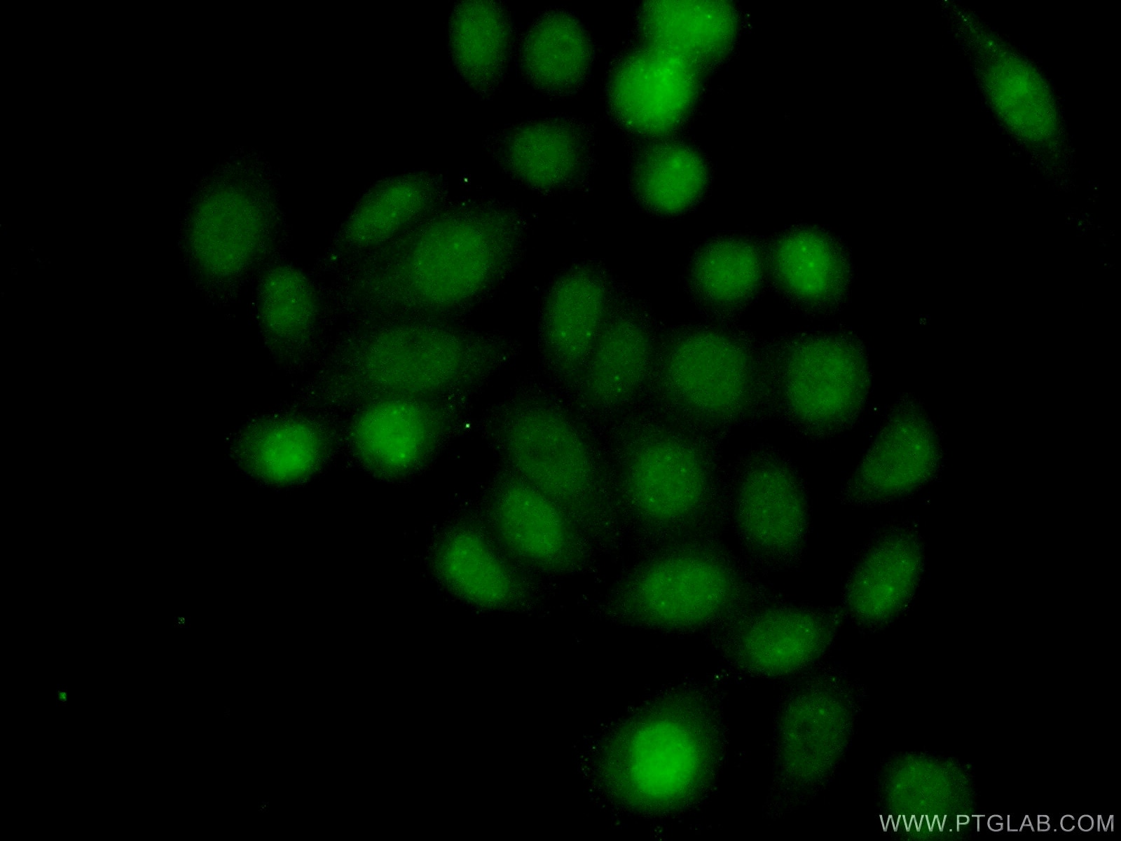 Immunofluorescence (IF) / fluorescent staining of HeLa cells using METTL4 Polyclonal antibody (17718-1-AP)