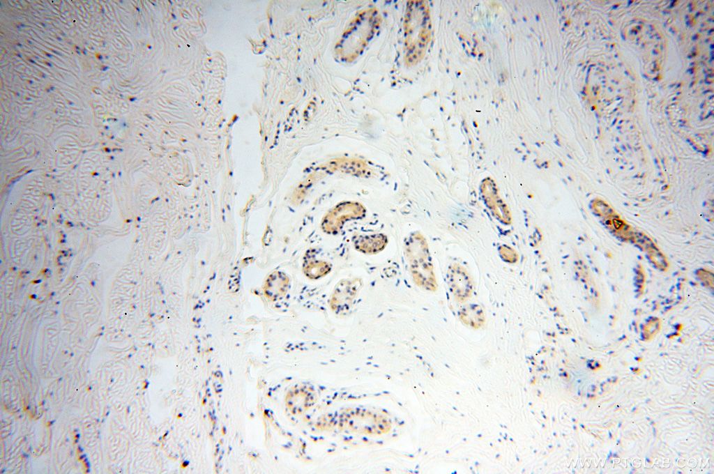 Immunohistochemistry (IHC) staining of human skin tissue using METTL4 Polyclonal antibody (17718-1-AP)