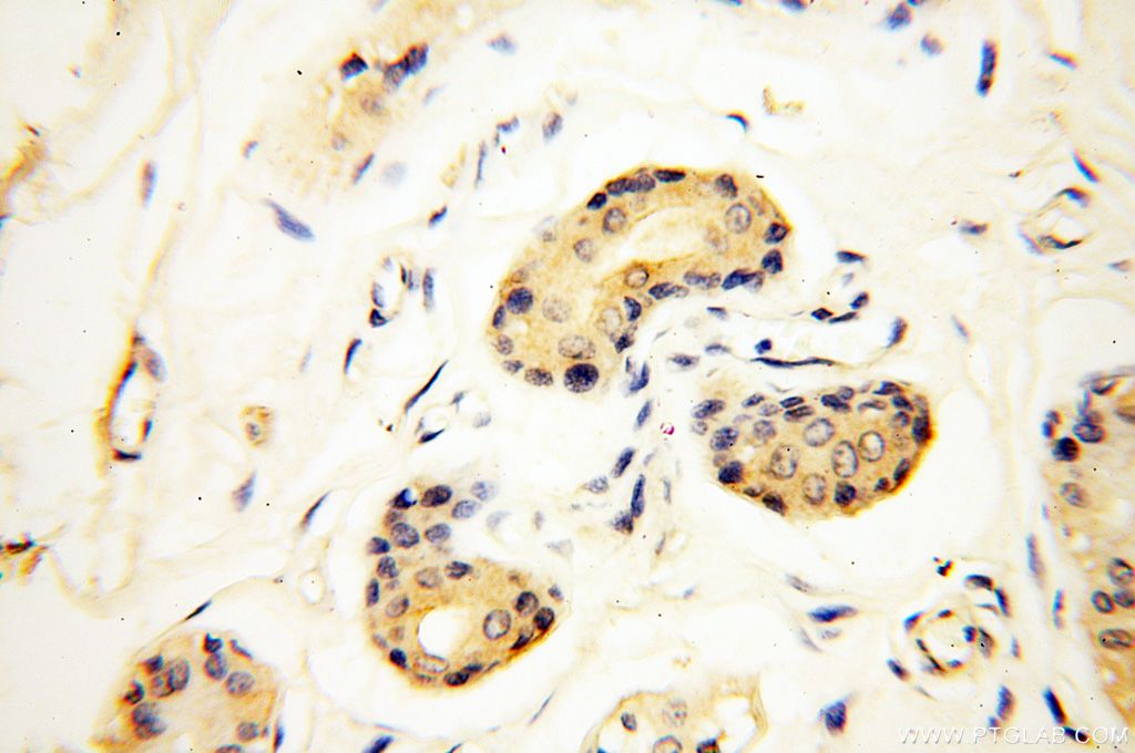 Immunohistochemistry (IHC) staining of human skin tissue using METTL4 Polyclonal antibody (17718-1-AP)