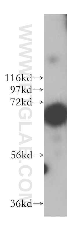 Western Blot (WB) analysis of MCF-7 cells using METTL4 Polyclonal antibody (17718-1-AP)