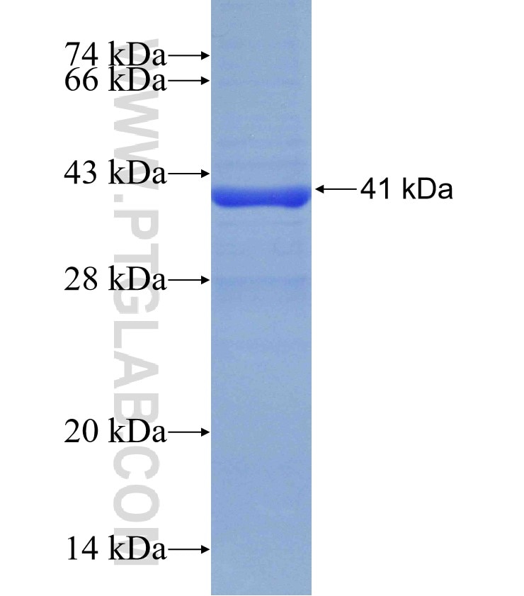 METTL4 fusion protein Ag31131 SDS-PAGE METTL4 fusion protein Ag31131 SDS-PAGE
