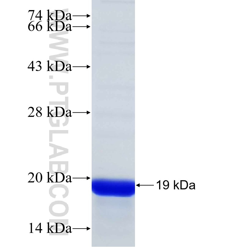 METTL4 fusion protein Ag31154 SDS-PAGE METTL4 fusion protein Ag31154 SDS-PAGE