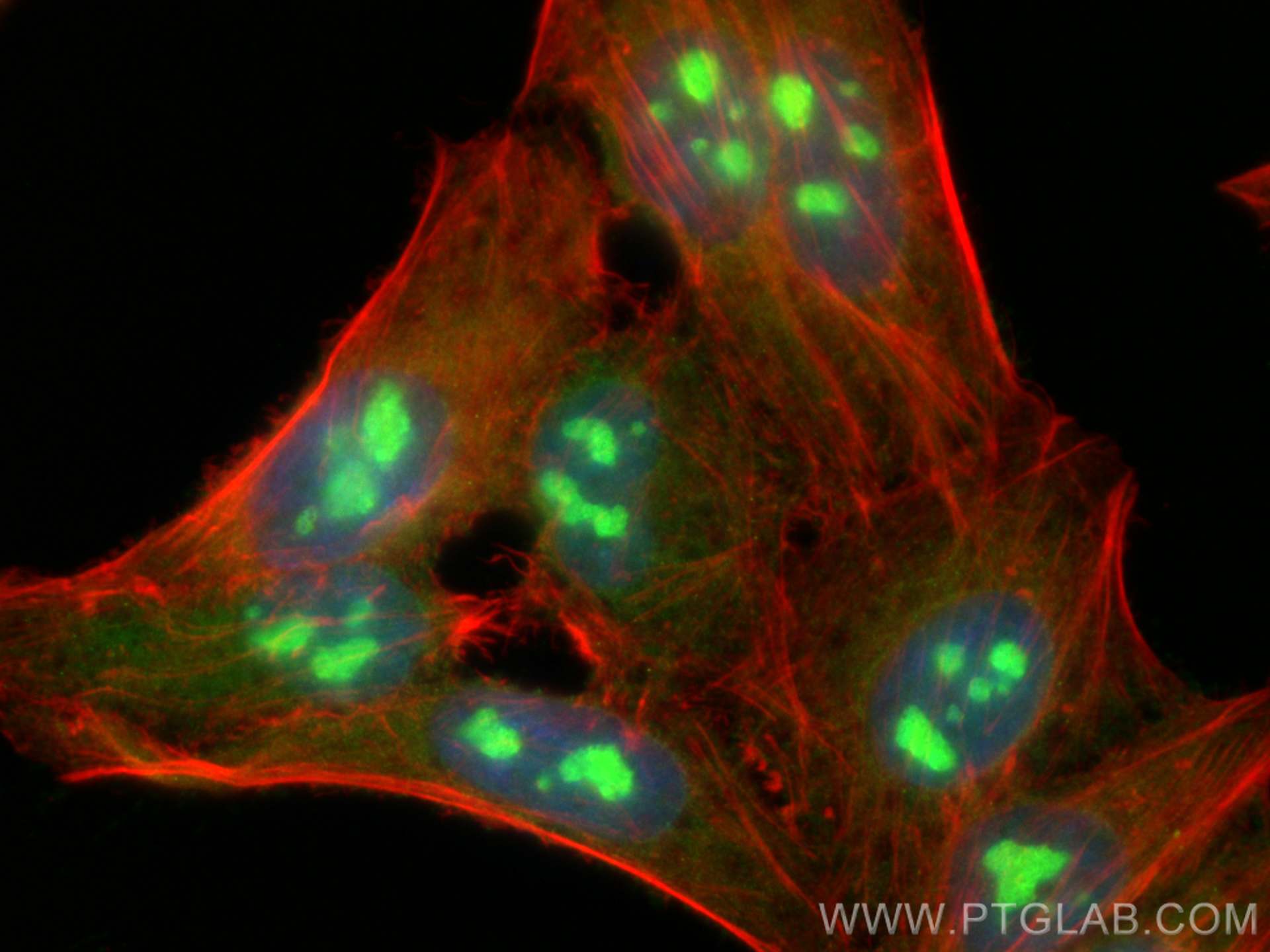 Immunofluorescence (IF) / fluorescent staining of HepG2 cells using METTL5 Polyclonal antibody (16791-1-AP)