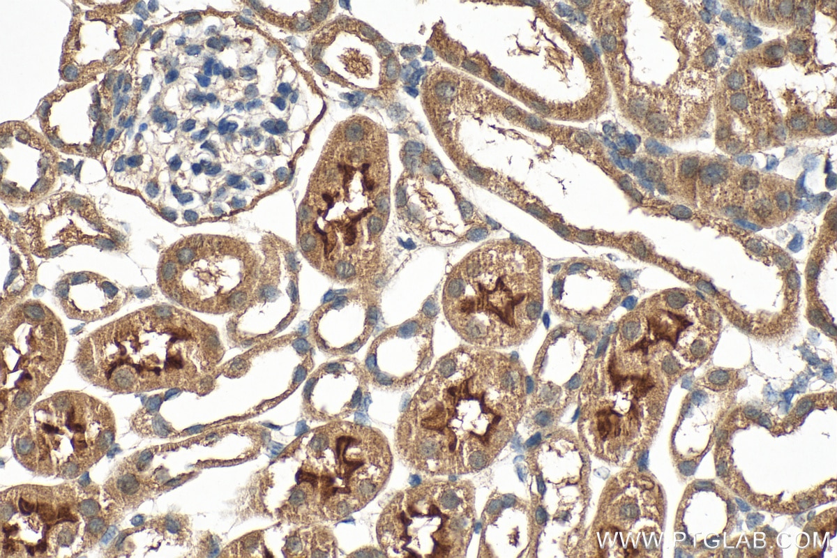 Immunohistochemistry (IHC) staining of mouse kidney tissue using METTL5 Polyclonal antibody (16791-1-AP)