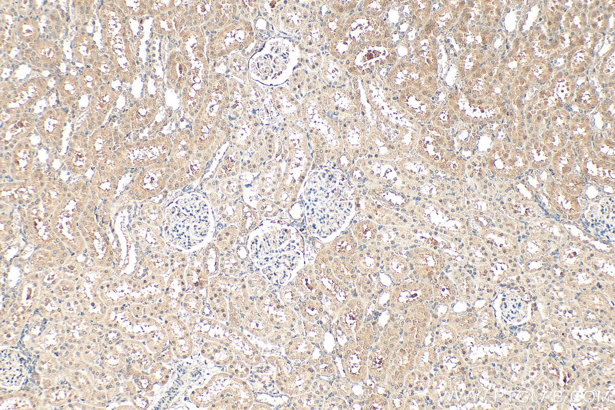 Immunohistochemistry (IHC) staining of rat kidney tissue using METTL5 Polyclonal antibody (16791-1-AP)