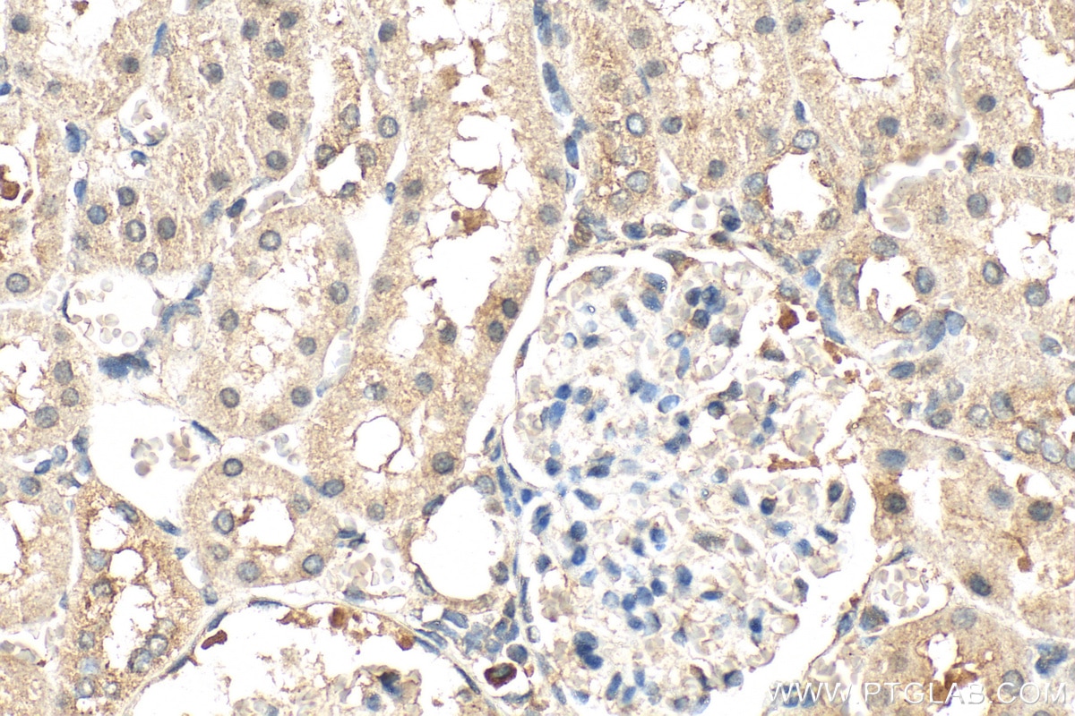 Immunohistochemistry (IHC) staining of rat kidney tissue using METTL5 Polyclonal antibody (16791-1-AP)