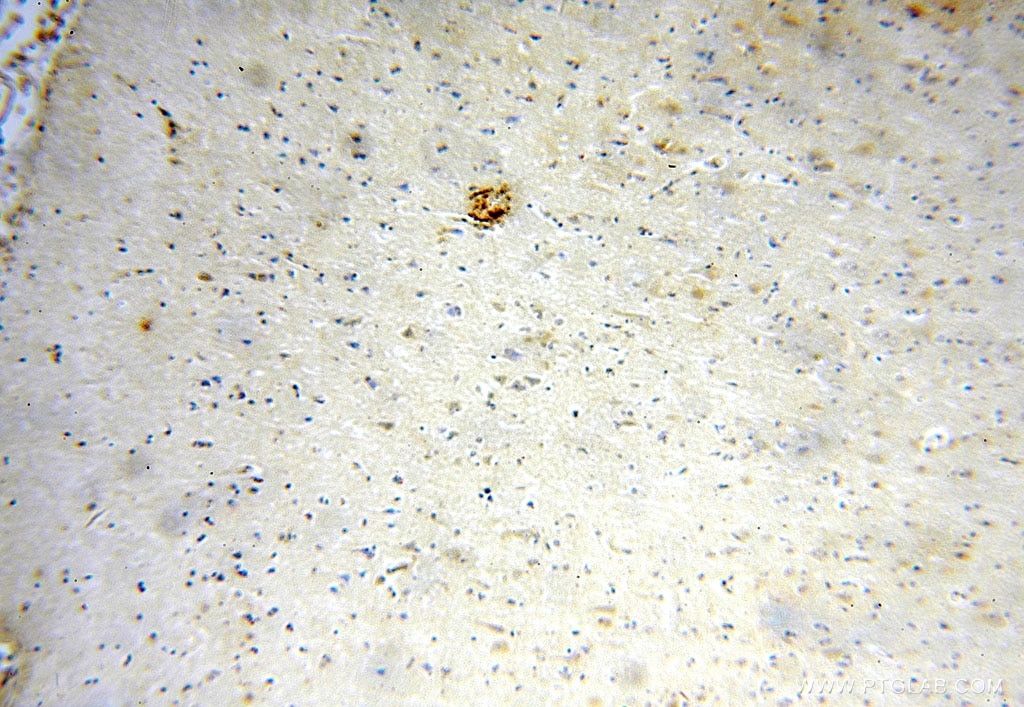 Immunohistochemistry (IHC) staining of human brain tissue using METTL5 Polyclonal antibody (16791-1-AP)