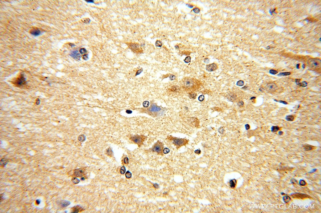 Immunohistochemistry (IHC) staining of human brain tissue using METTL5 Polyclonal antibody (16791-1-AP)